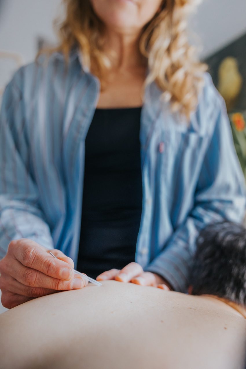 Acupuncture juillet3