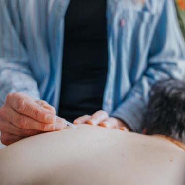 Acupuncturejuillet2026